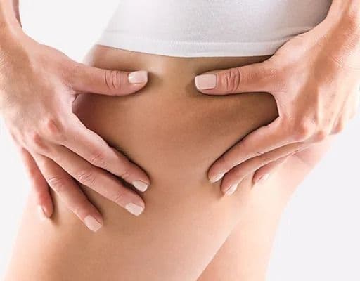 Vezelcellulite